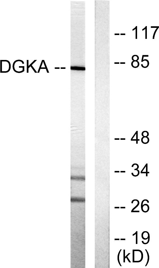 DGK-α Rabbit Polyclonal Antibody