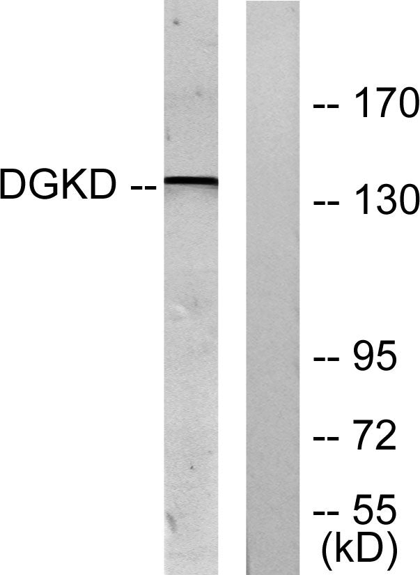 DGK-δ Rabbit Polyclonal Antibody