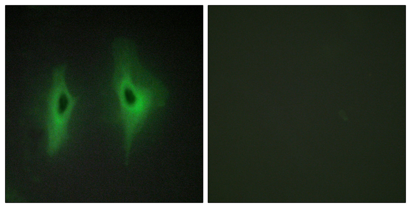 DGK-η Rabbit Polyclonal Antibody