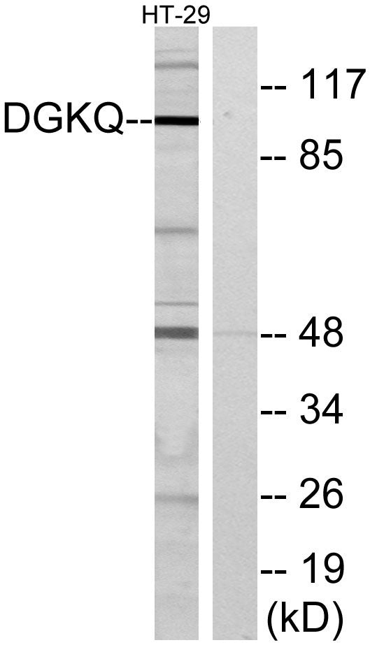 DGK-θ Rabbit Polyclonal Antibody