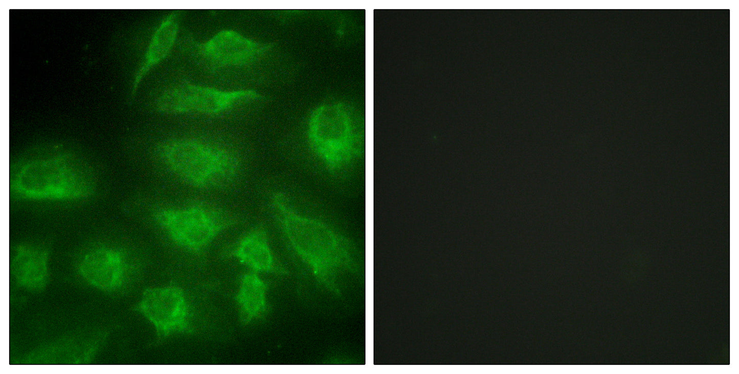 DGK-ι Rabbit Polyclonal Antibody
