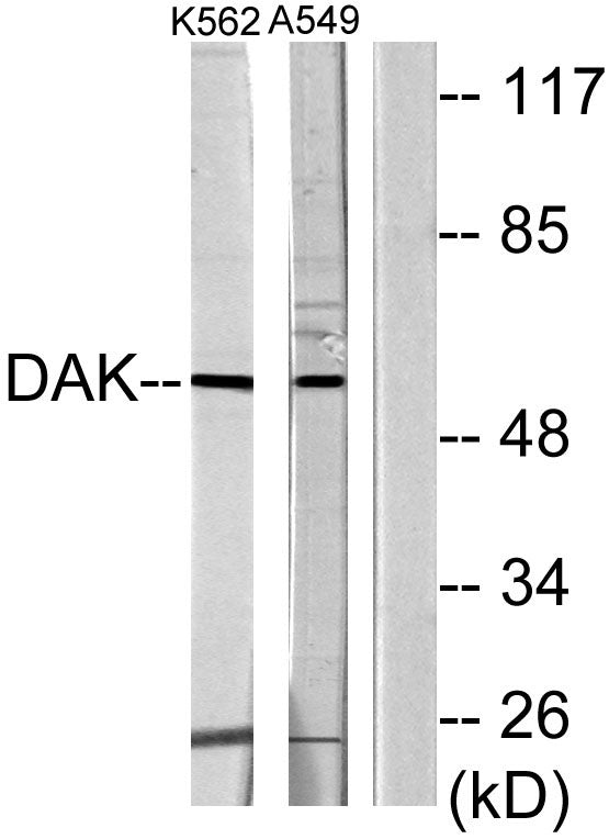 DHA Kinase Rabbit Polyclonal Antibody
