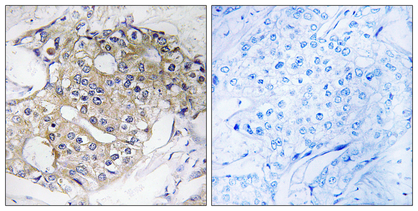 DHRS4 Rabbit Polyclonal Antibody