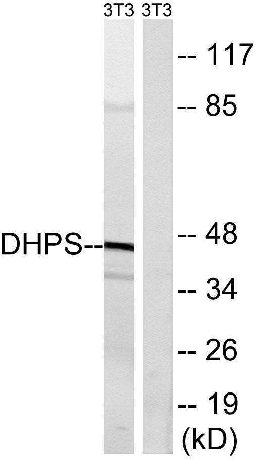 DHS Rabbit Polyclonal Antibody