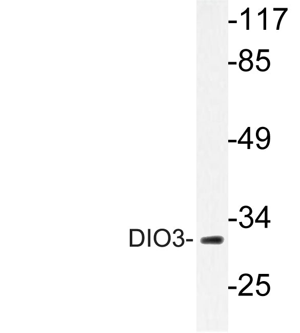 DIO3 Rabbit Polyclonal Antibody