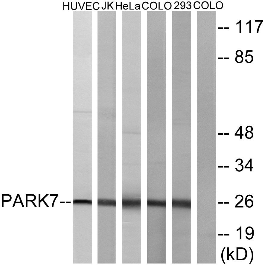 DJ-1 Rabbit Polyclonal Antibody