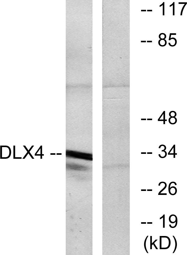 Dlx-4 Rabbit Polyclonal Antibody