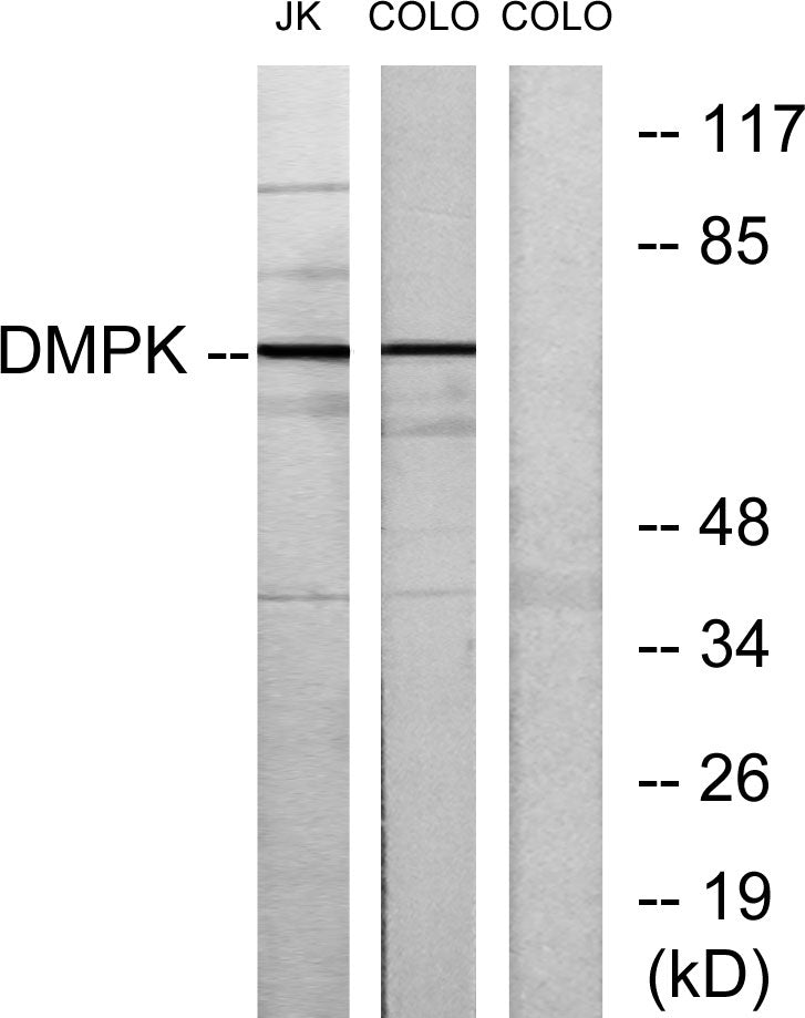 DMPK Rabbit Polyclonal Antibody