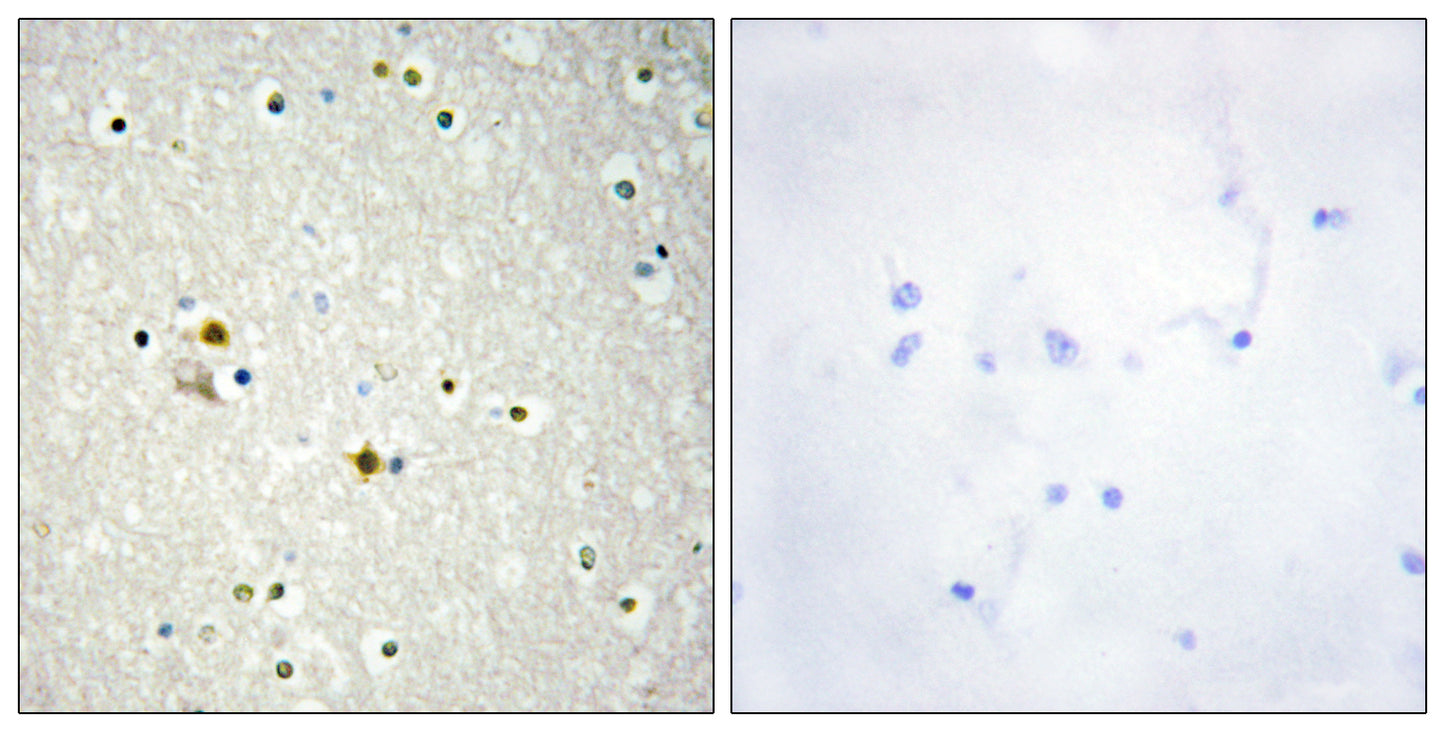 DNA Ligase I Rabbit Polyclonal Antibody