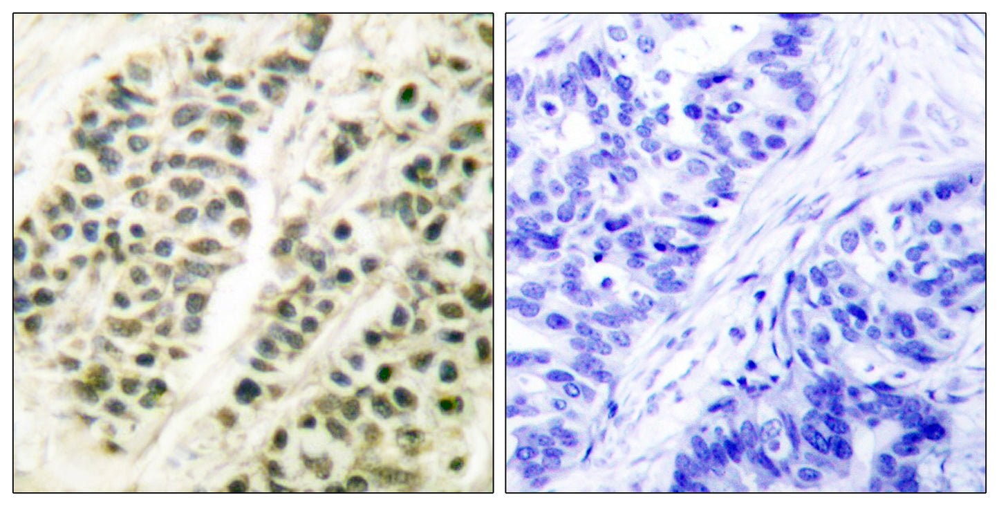 DNA pol β Rabbit Polyclonal Antibody