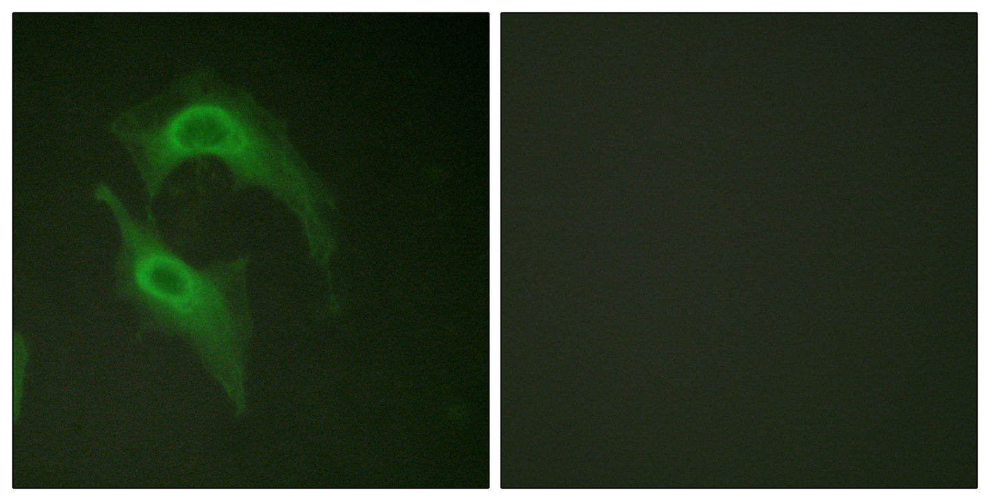 DNAM-1 Rabbit Polyclonal Antibody