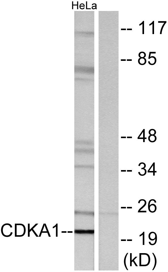 DOC-1 Rabbit Polyclonal Antibody