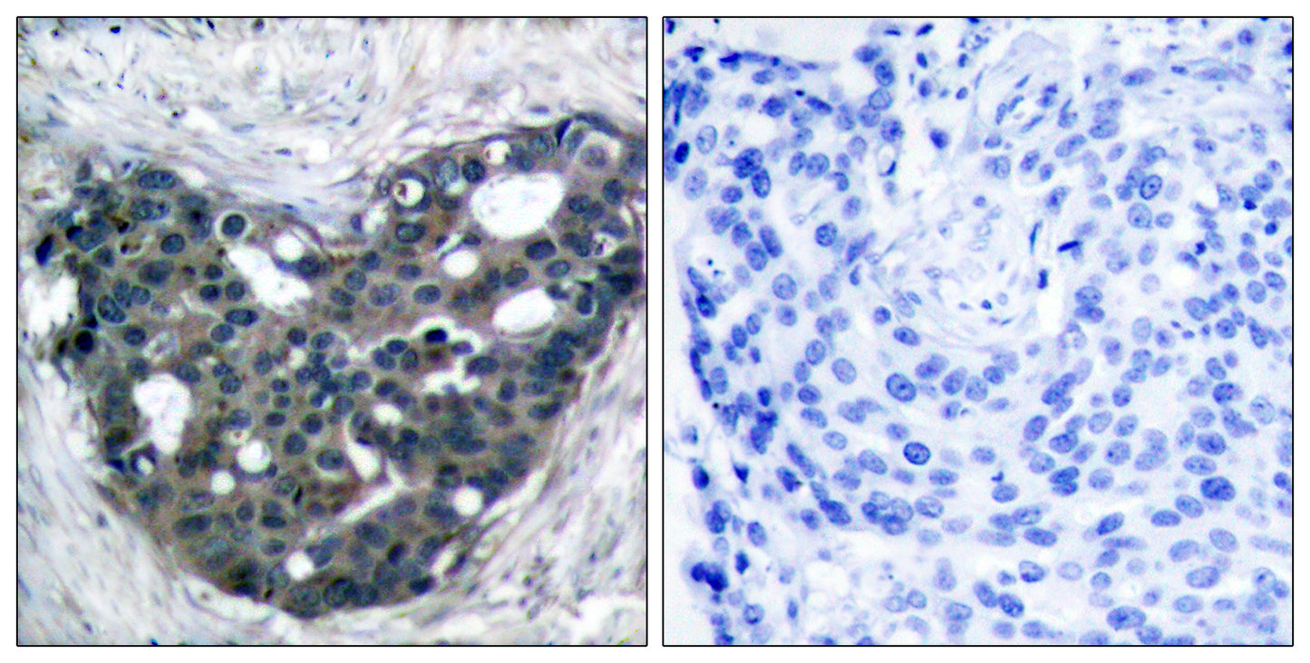Dok-2 Rabbit Polyclonal Antibody