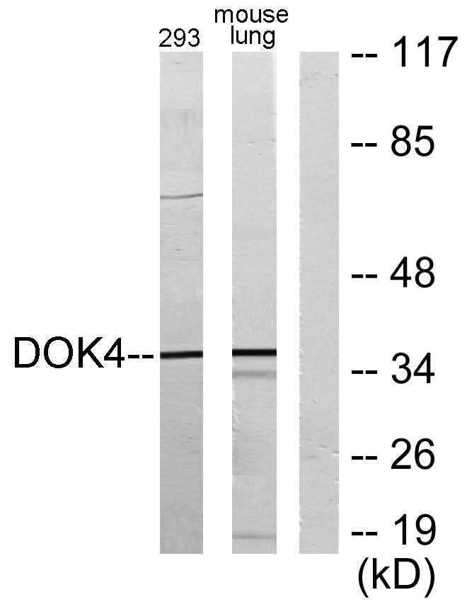 Dok-4 Rabbit Polyclonal Antibody