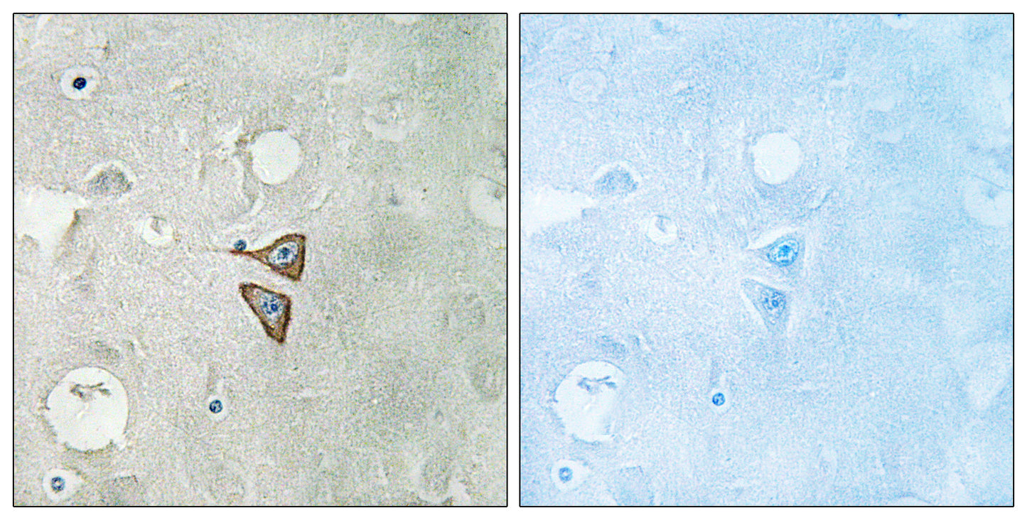 DOR-1 Rabbit Polyclonal Antibody
