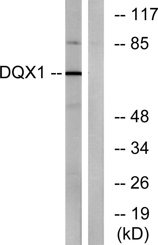 DQX1 Rabbit Polyclonal Antibody
