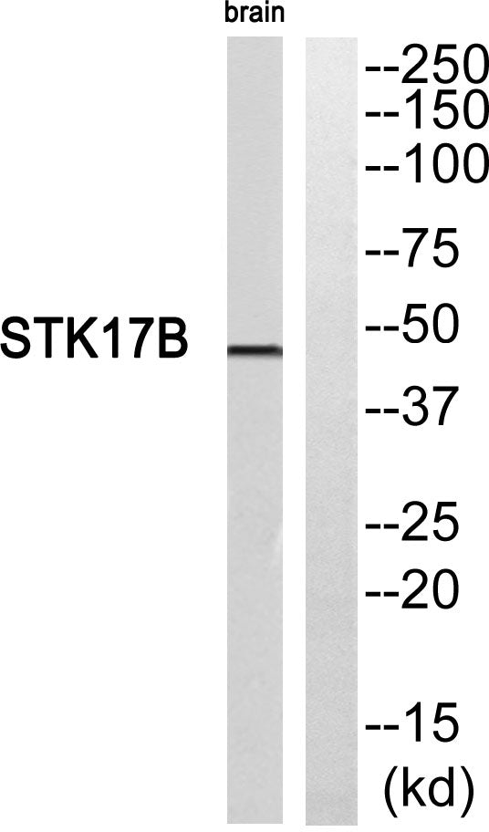 DRAK2 Rabbit Polyclonal Antibody