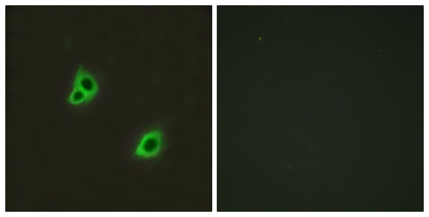 DREG Rabbit Polyclonal Antibody