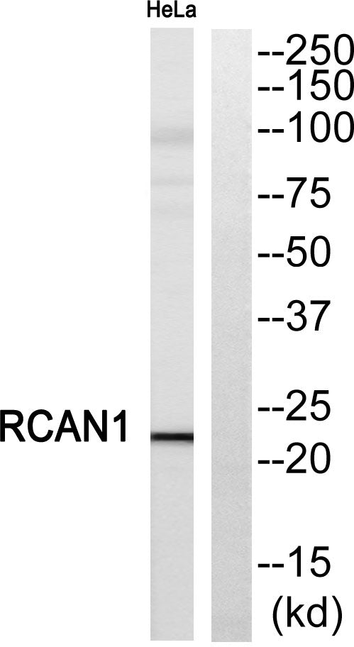 DSCR 1 Rabbit Polyclonal Antibody