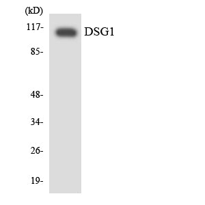 Dsg1 Rabbit Polyclonal Antibody
