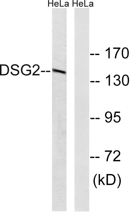 Dsg2 Rabbit Polyclonal Antibody