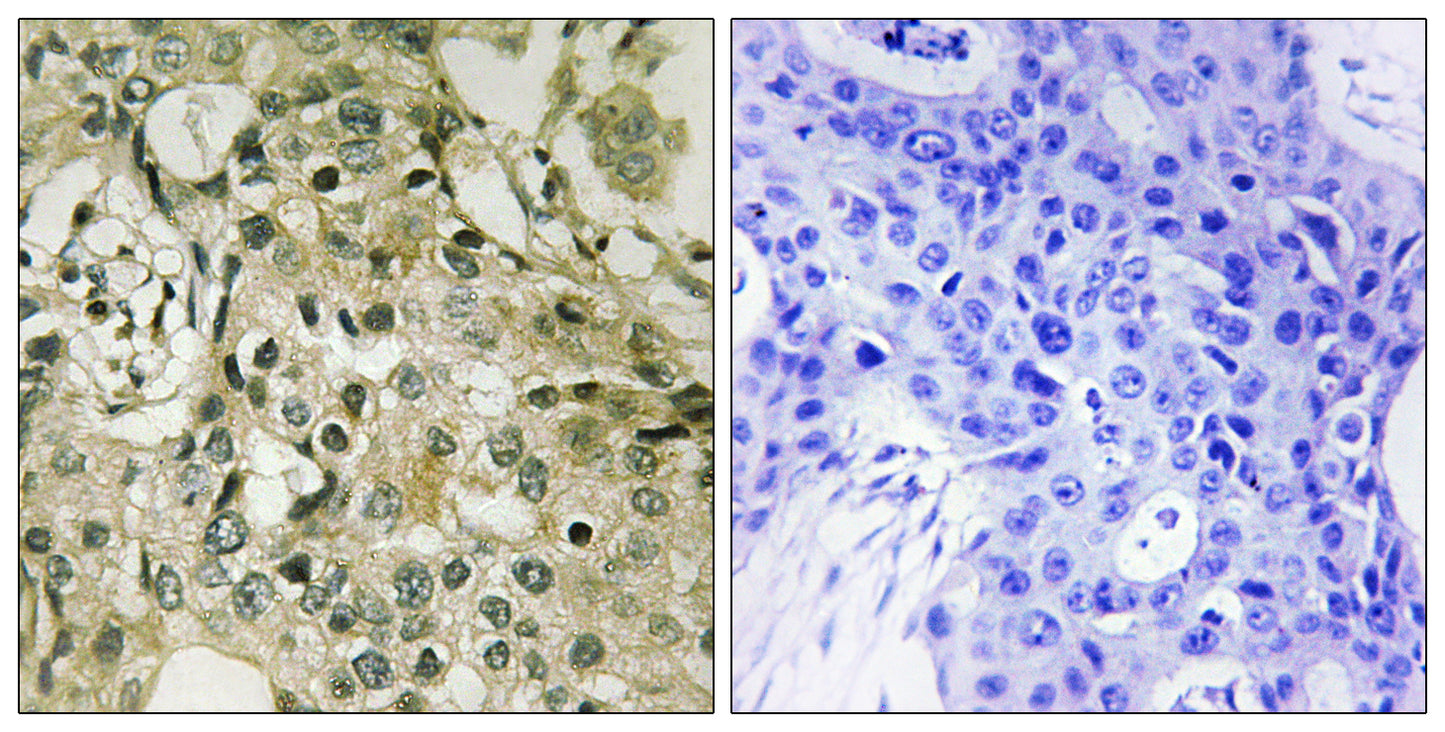 dTMP Kinase Rabbit Polyclonal Antibody