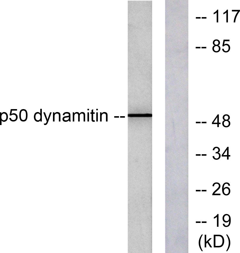Dynactin 2 Rabbit Polyclonal Antibody