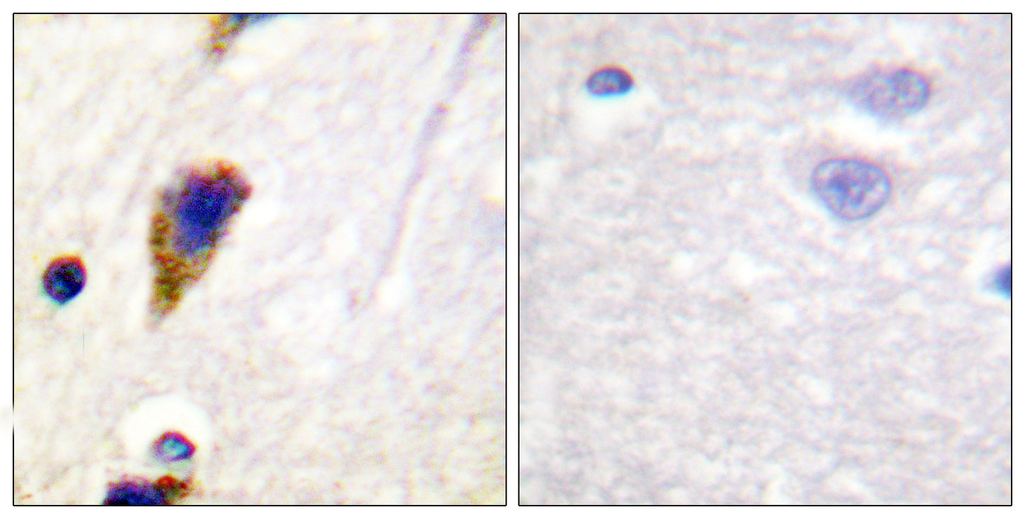 Dynamin I Rabbit Polyclonal Antibody