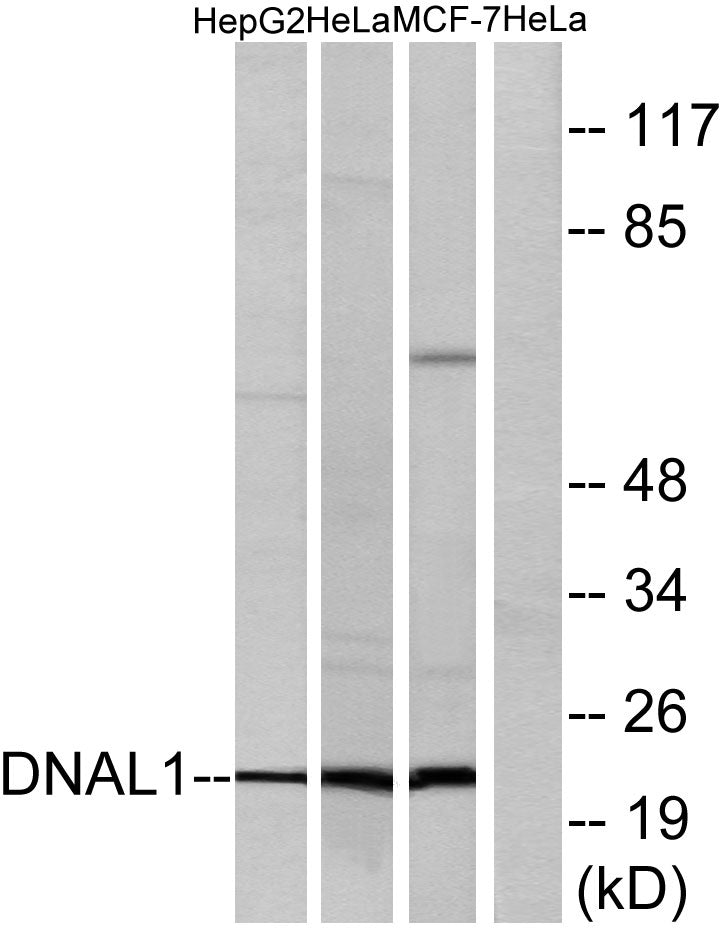 Dynein LC 1 Rabbit Polyclonal Antibody