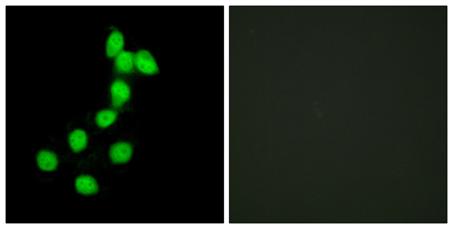 Dyrk1A Rabbit Polyclonal Antibody