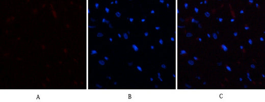 E2F-1 Rabbit Polyclonal Antibody