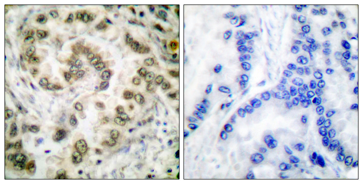E2F-4/5 Rabbit Polyclonal Antibody