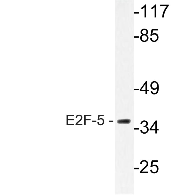 E2F-5 Rabbit Polyclonal Antibody