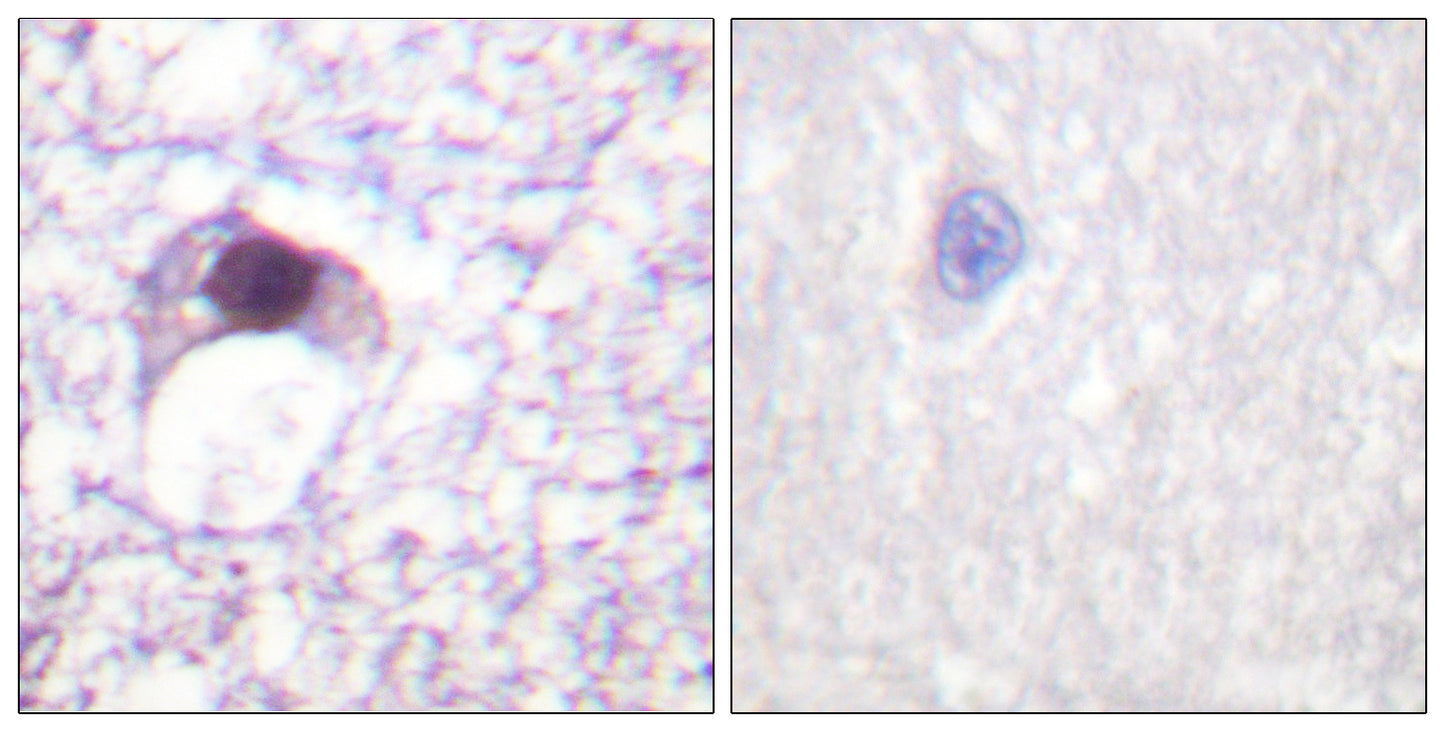 E2F-6 Rabbit Polyclonal Antibody