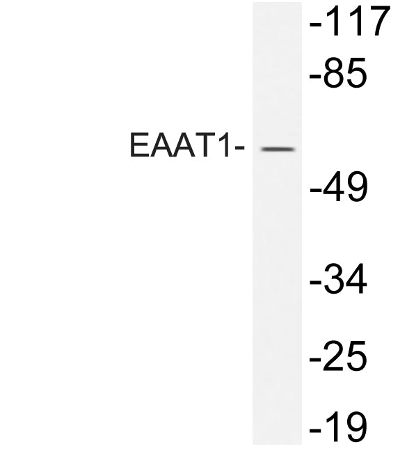 EAAT1 Rabbit Polyclonal Antibody