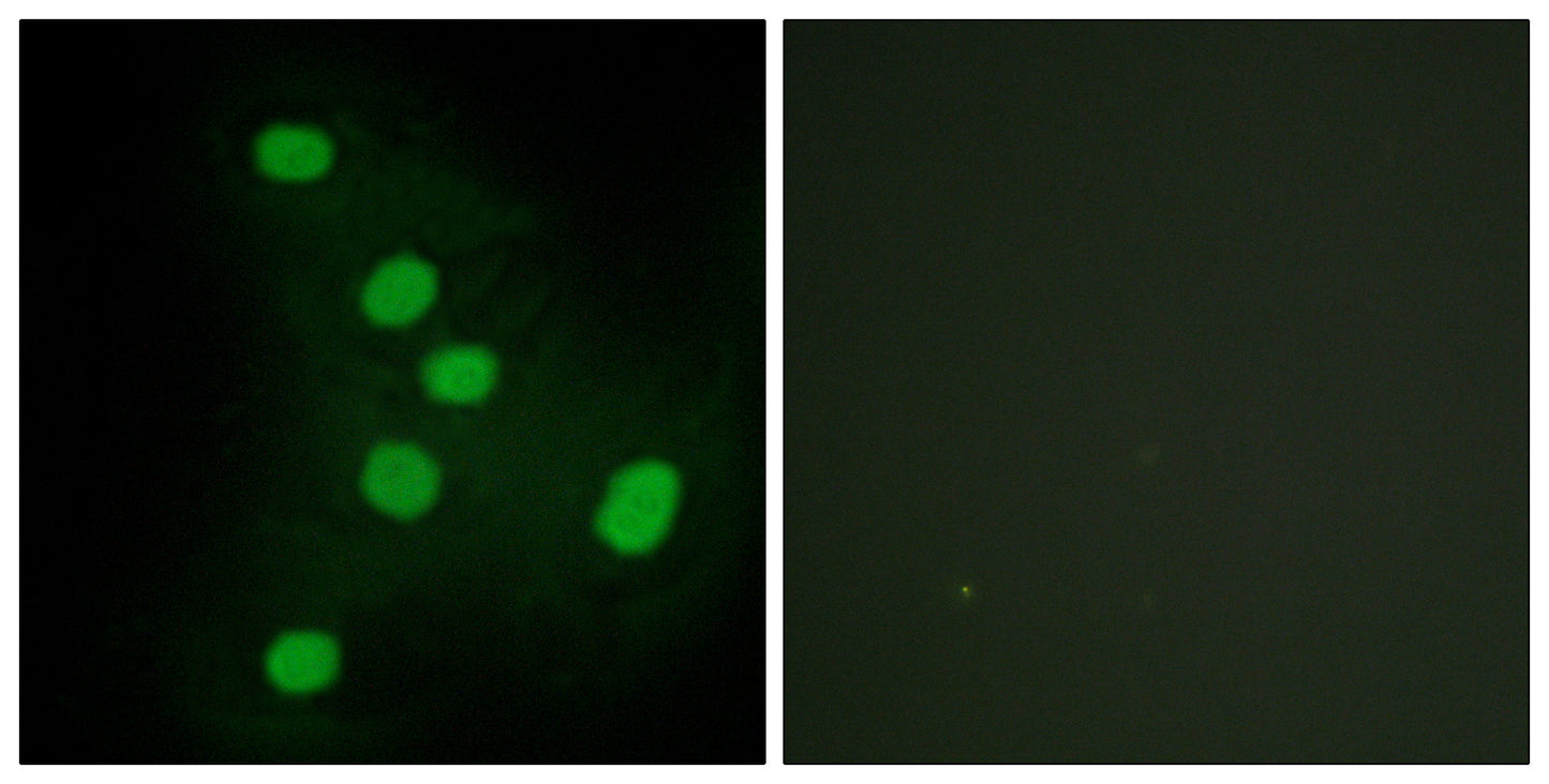 EAR2 Rabbit Polyclonal Antibody