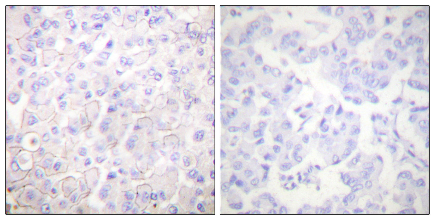 E-cadherin Rabbit Polyclonal Antibody