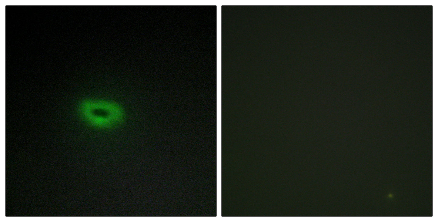 ECRG4 Rabbit Polyclonal Antibody