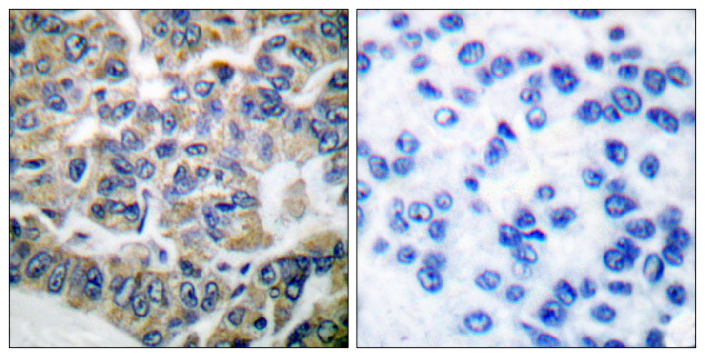 eEF2K Rabbit Polyclonal Antibody
