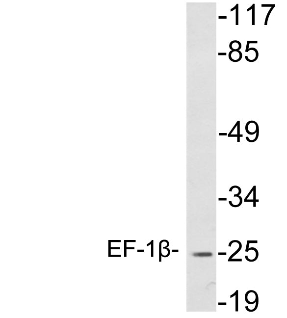 EF-1β Rabbit Polyclonal Antibody