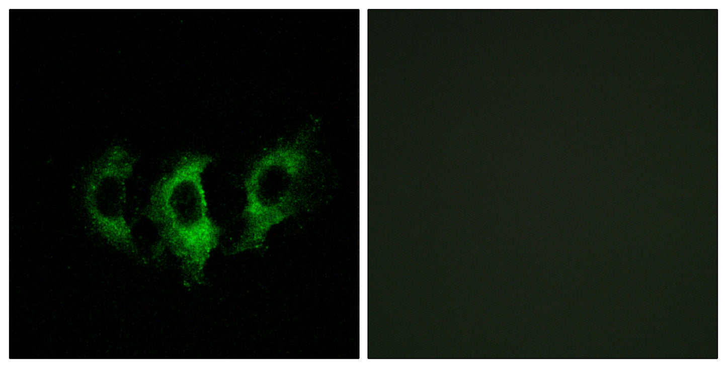 EF-G2 Rabbit Polyclonal Antibody