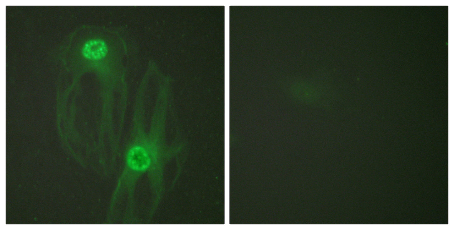 Eg5 Rabbit Polyclonal Antibody