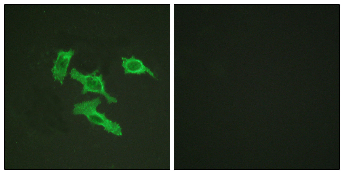 EGFR Rabbit Polyclonal Antibody