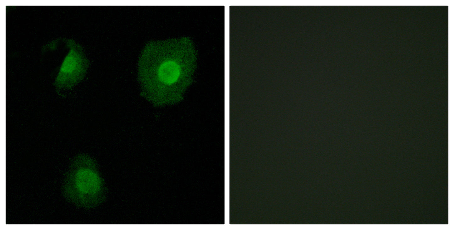 EID-1 Rabbit Polyclonal Antibody