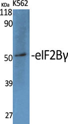 eIF2Bγ Rabbit Polyclonal Antibody
