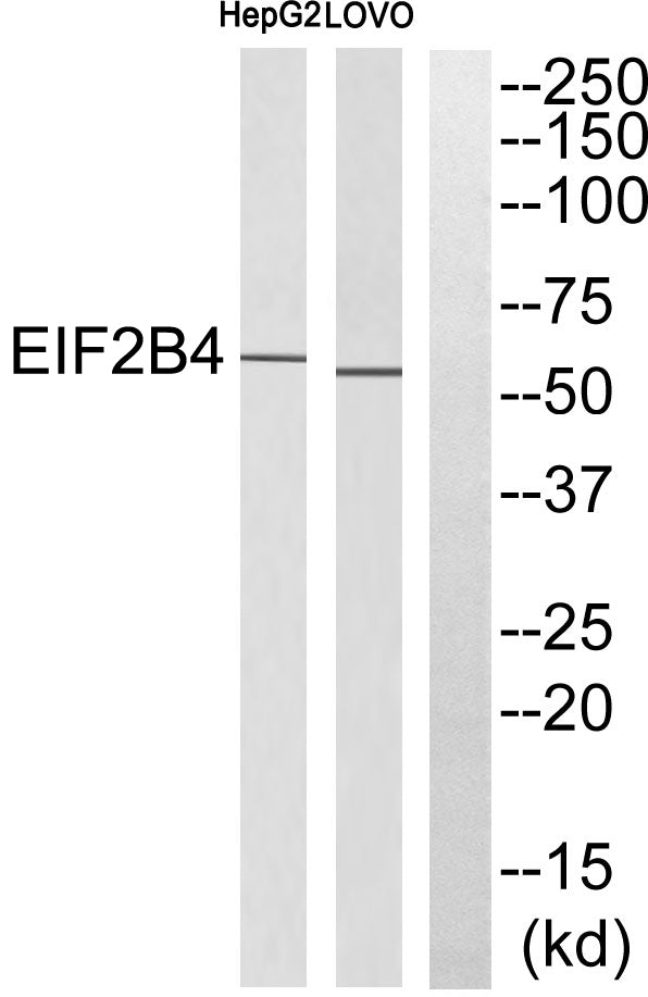 eIF2Bδ Rabbit Polyclonal Antibody