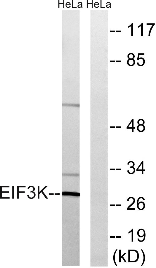 eIF3K Rabbit Polyclonal Antibody