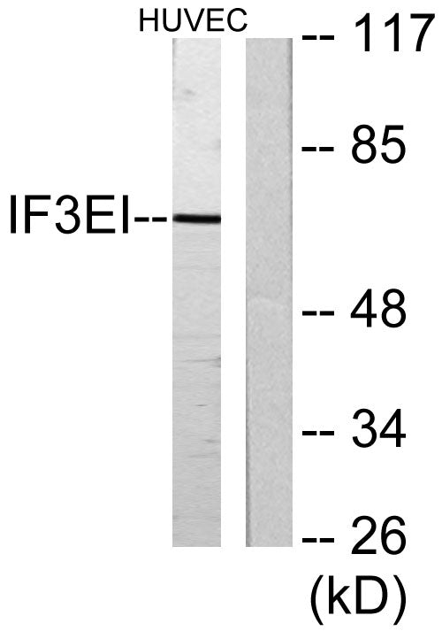 eIF3L Rabbit Polyclonal Antibody