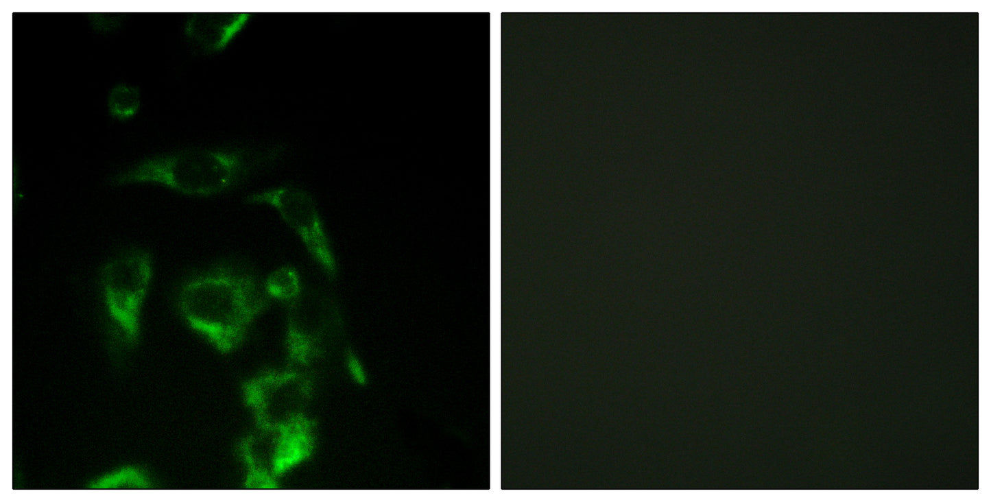 eIF4G Rabbit Polyclonal Antibody