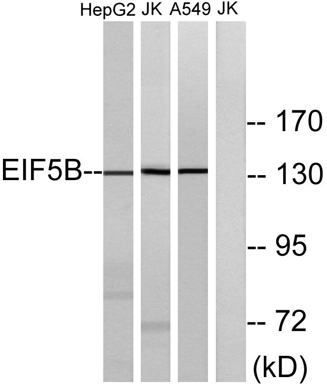 eIF5B Rabbit Polyclonal Antibody